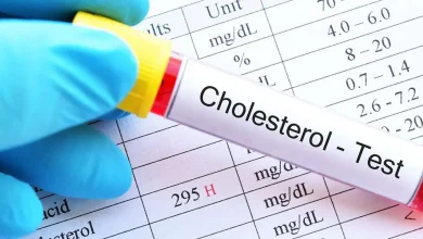 چند غذای پر از کلسترول که باید از خوردن آنها پرهیز کنید