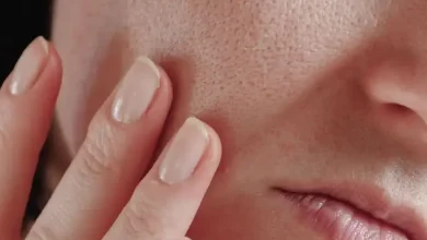 منافذ باز پوست صورت چیست و درمان آن