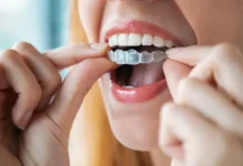 ارتودنسی نامرئی چیست؟