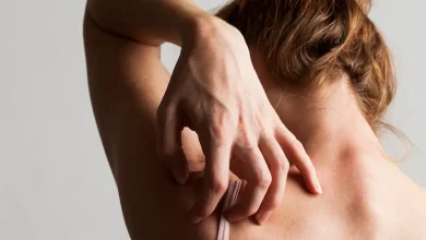 علت خارش بدن چیست؟