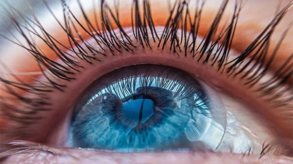 سلامت چشم ها سرمایه ای ارزشمند